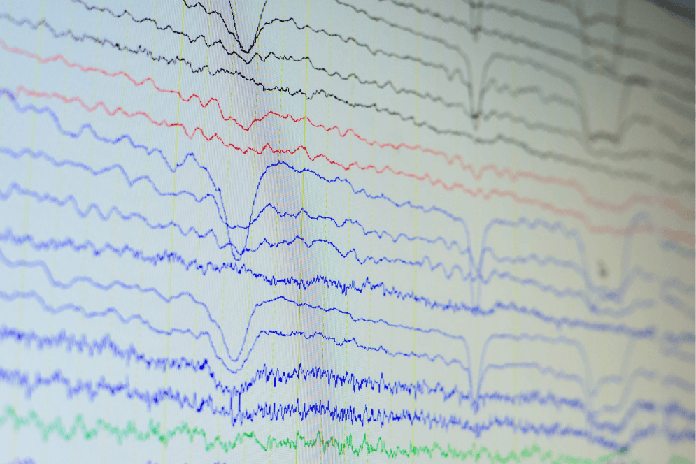 Sleep Study Scoring